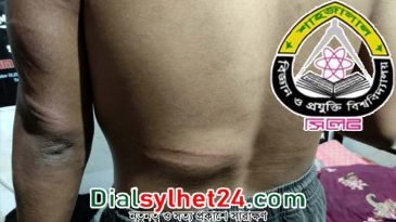 শাবিতে ছাত্রলীগের দুই গ্রুপের মারামারি, আহত ১