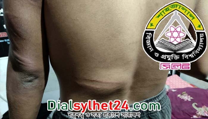 শাবিতে ছাত্রলীগের দুই গ্রুপের মারামারি, আহত ১