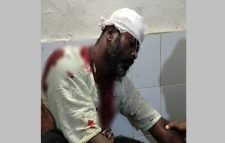 বড়লেখায় প্রতিপক্ষের লোকজনের হামলায় এক ব্যক্তি গুরুতর আহত সরিষা ক্ষেত নিয়ে কথা কাটাকাটির জের