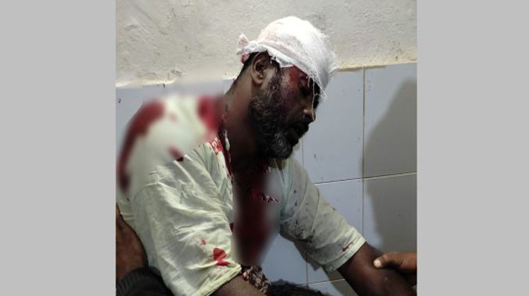 বড়লেখায় প্রতিপক্ষের লোকজনের হামলায় এক ব্যক্তি গুরুতর আহত সরিষা ক্ষেত নিয়ে কথা কাটাকাটির জের