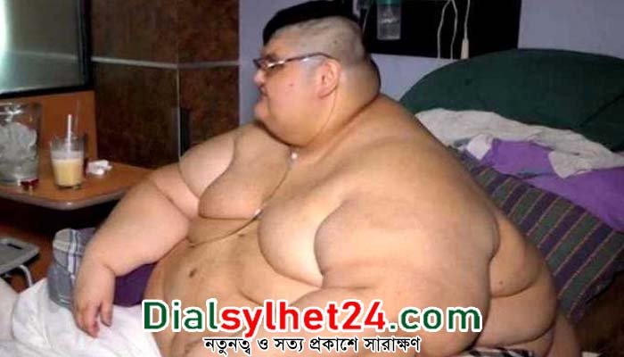 ২০৩৫ সালের মধ্যে অতিরিক্ত মোটা হবেন ৪০০ কোটি মানুষ