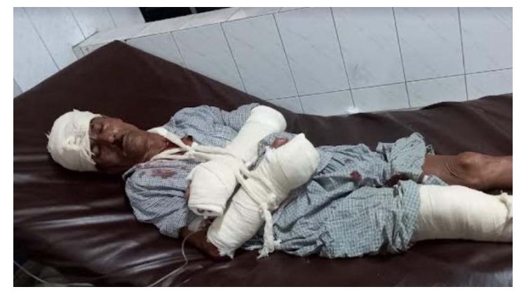 কুলাউড়ায় জায়গা নিয়ে বিরোধের জেরে হামলা, আহত ২