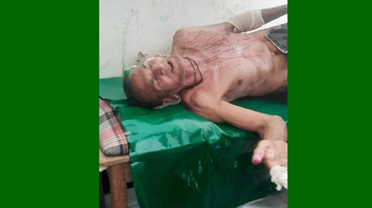 কুলাউড়ায় প্রতিপক্ষের হামলায় আহত ১, গ্রেপ্তার ২