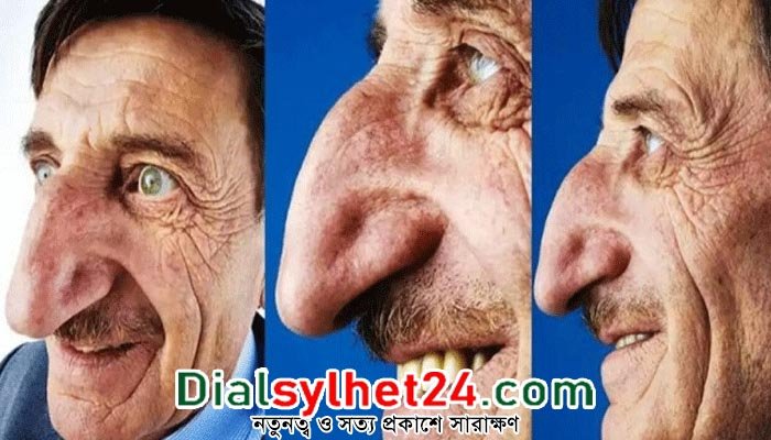 বিশ্বের সবচেয়ে লম্বা নাকের অধিকারী মেহমেত আর নেই