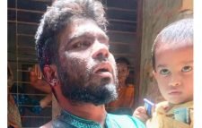 শশুরবাড়ির লোকজন রড দিয়ে আঘাত গুরুতর রক্তাক্ত জখম