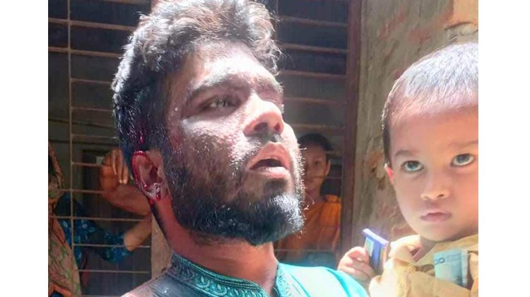 শশুরবাড়ির লোকজন রড দিয়ে আঘাত গুরুতর রক্তাক্ত জখম