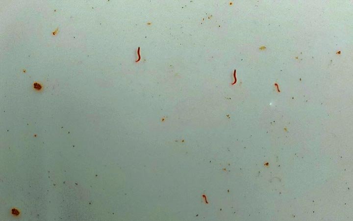 শাবির হোস্টেলের পানিতে ময়লা ও কেঁচো