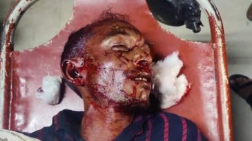 বাড়ি ফেরার পথে অজ্ঞাত গাড়ির চাপায় রিপন মিয়া (৩৫) নামে এক যুবকের মর্মান্তিক মৃত্যু 
