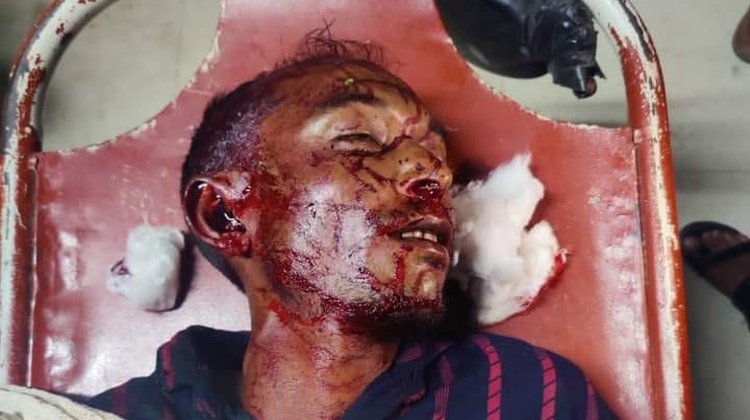 বাড়ি ফেরার পথে অজ্ঞাত গাড়ির চাপায় রিপন মিয়া (৩৫) নামে এক যুবকের মর্মান্তিক মৃত্যু 