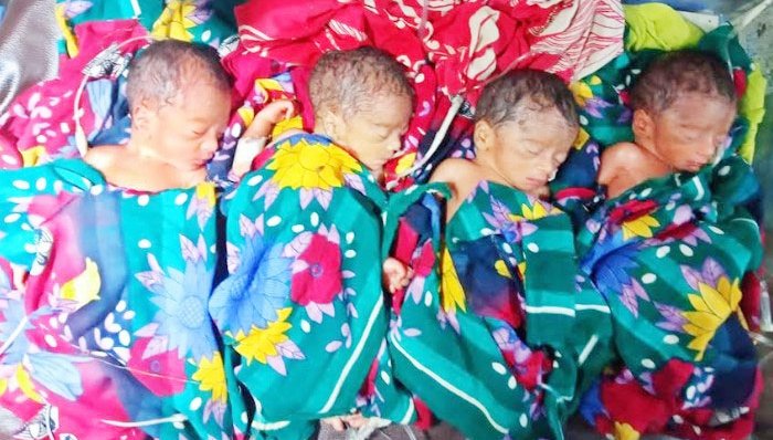 সিলেটে একসঙ্গে জন্ম নেওয়া চার শিশুর মধ্যে মারা গেল ২ জন