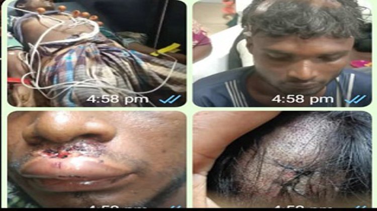 রাজনগরে প্রতিপক্ষের হামলা- আহত-৪