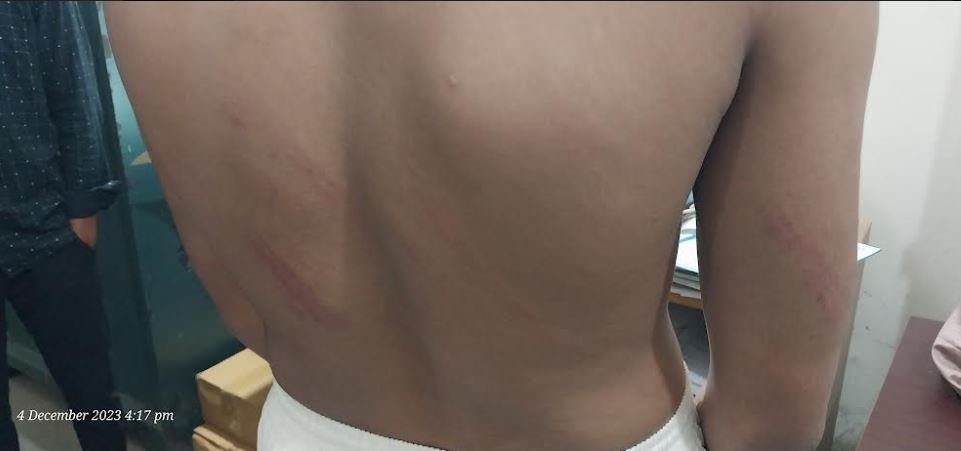 কুলাউড়া আহমদাবাদ মাদ্রাসায় শিক্ষার্থীকে অমানবিক নির্যাতন