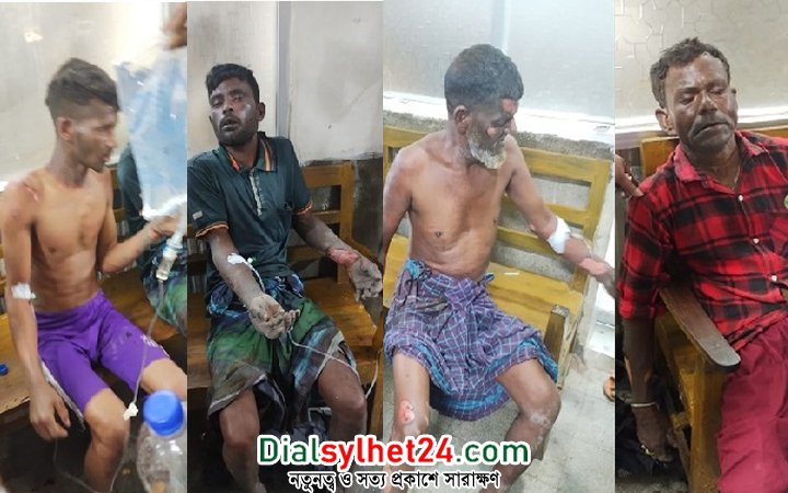 সিলেটে সিএনজি ফিলিং স্টেশনে আগুন, দগ্ধ ৫