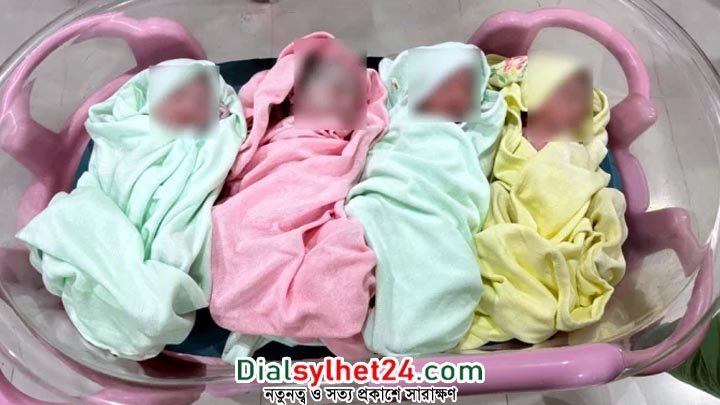 সিলেটে একসাথে চার সন্তানের জন্ম