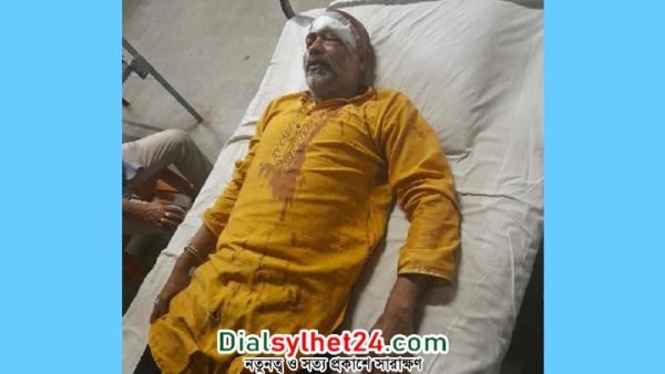 সিলেটে দিনে রেস্টুরেন্ট খোলা রাখায় হামলায় আহত ১