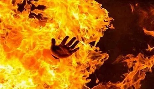 রাজধানীর শ্যামপুরে গ্যাস লিকেজ থেকে আগুনে ৩ জন দগ্ধ