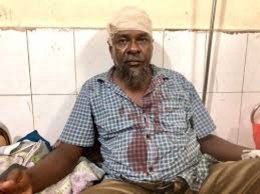 দিরাইয়ে সংঘবদ্ধ সন্ত্রাসী হামলায় হামলায় ব্যবসায়ী আহত